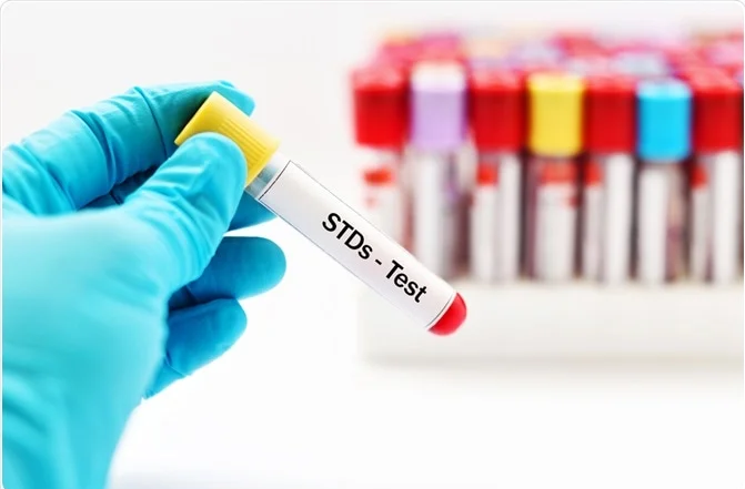 STDs Treatment